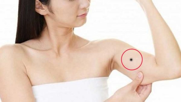 Nốt ruồi ở bắp tay trái, phải phụ nữ nói nên điều gì?